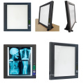 medical film viewer x ray viewer led x-ray viewing box x-ray viewing light box